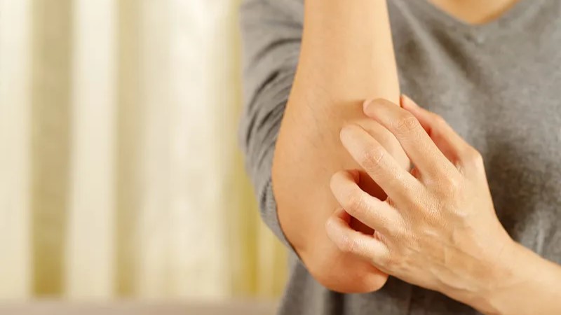 冬季皮膚瘙癢可預(yù)防 專家講解如何護(hù)膚